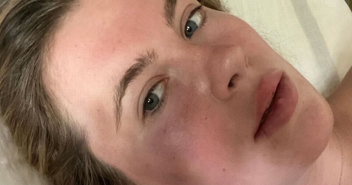 Alec Baldwin’s model daughter Ireland punched in the face by ‘desperate’ mugger