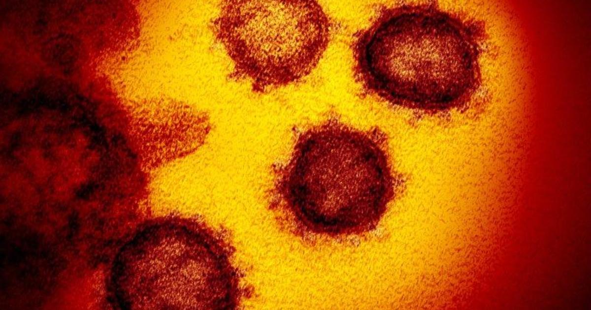 Coronavirus is third-biggest killer of Black Americans, experts say