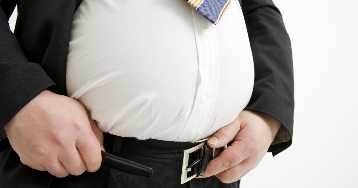 Roughly 40% of U.S. adults are obese, 10% very much so, CDC says