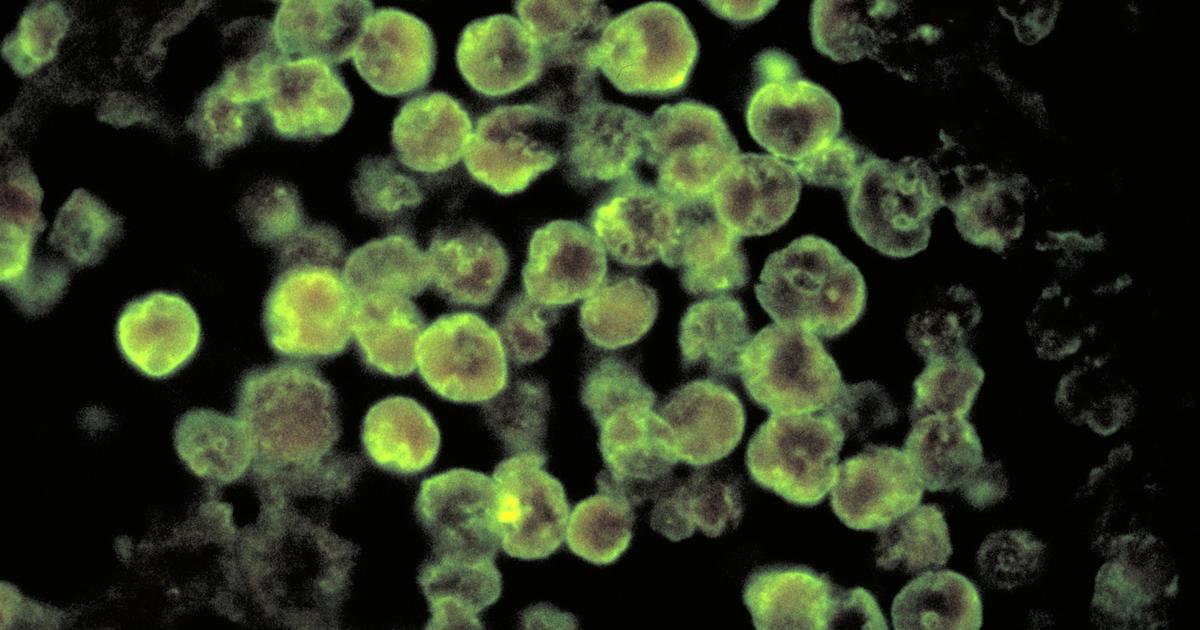 Texas governor issues disaster declaration over brain-eating amoeba