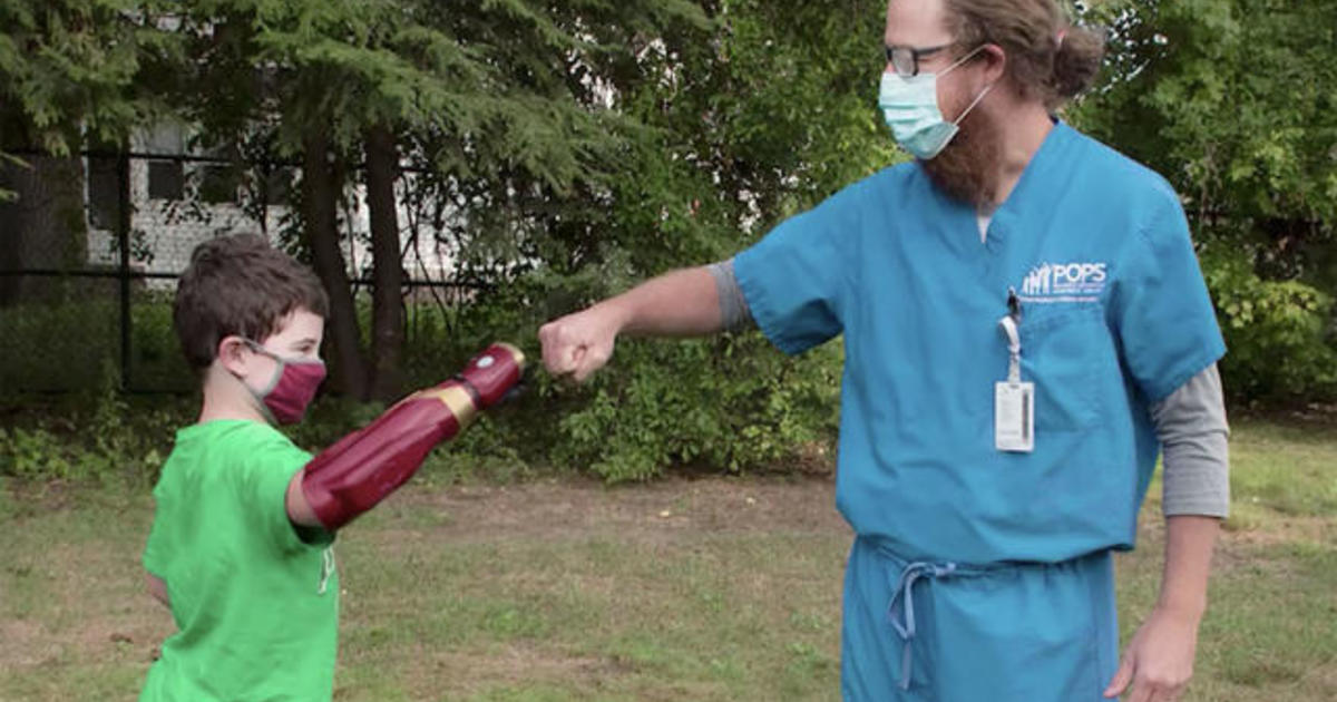 8-year-old boy receives bionic “Hero Arm”