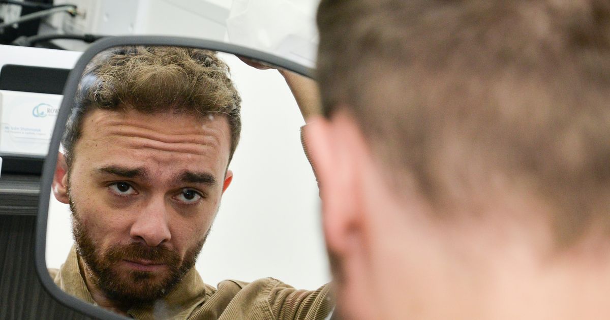 Corrie’s Jack P Shepherd proudly displays results of second hair transplant