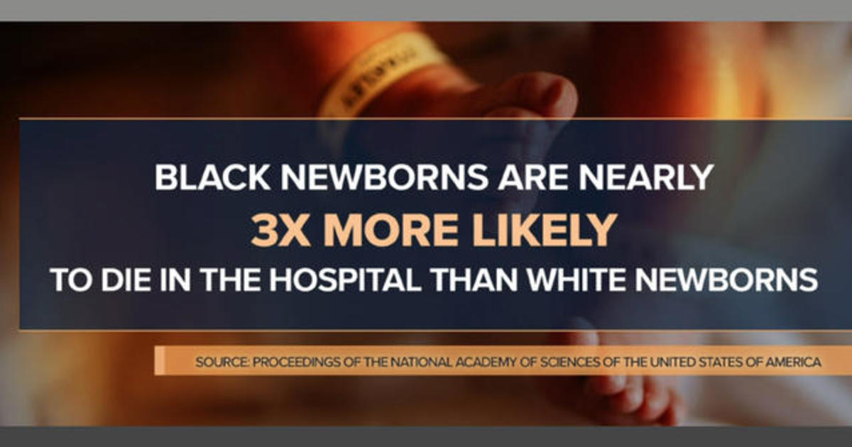 New study reveals that Black newborns are more likely to survive under care of Black doctor