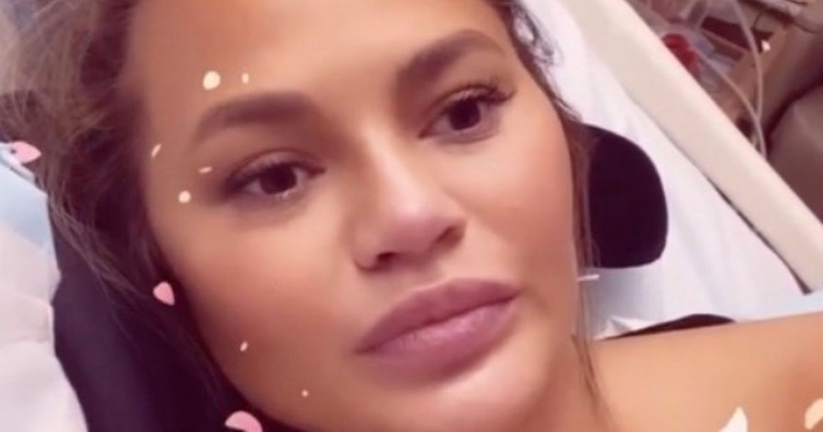 Pregnant Chrissy Teigen insists she and baby are fine after blood transfusions