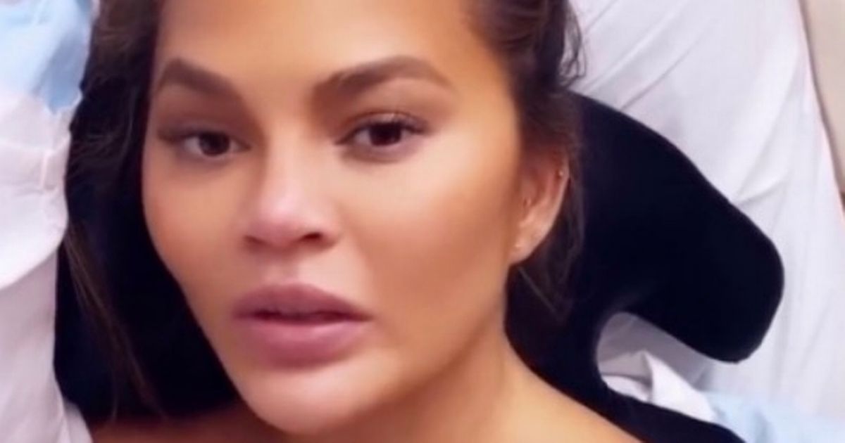 Pregnant Chrissy Teigen’s horror scare as she scrambled to hear baby’s heartbeat