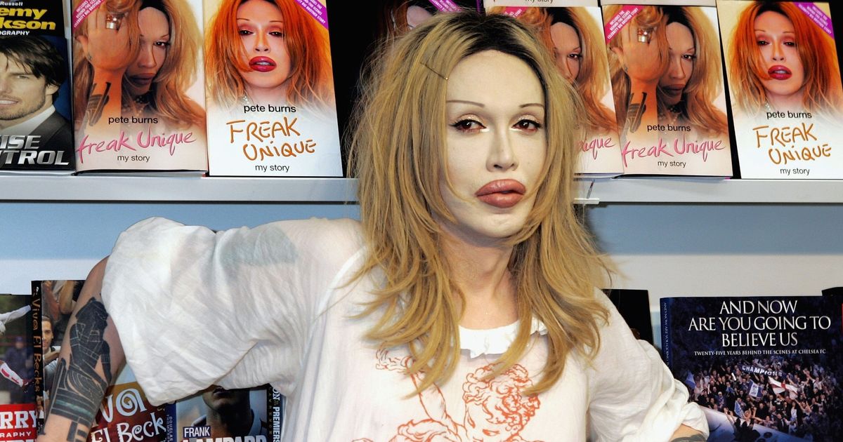 Tragic end of Pete Burns after fame, drugs and spiral into bankruptcy