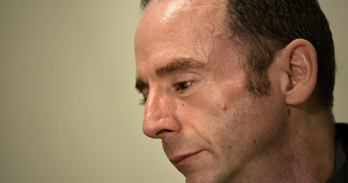 Man “cured” of AIDS: Timothy Ray Brown