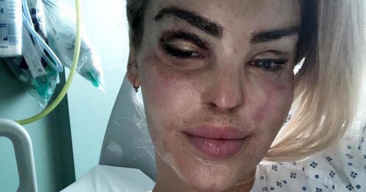 Katie Piper shares update from hospital bed after undergoing 400th operation