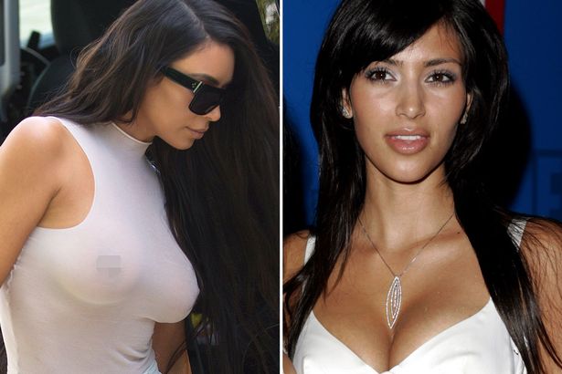 Kim Kardashian before and after boob jobs