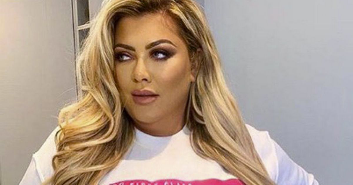 Gemma Collins shows off her ‘real face’ after having chin fat dissolved