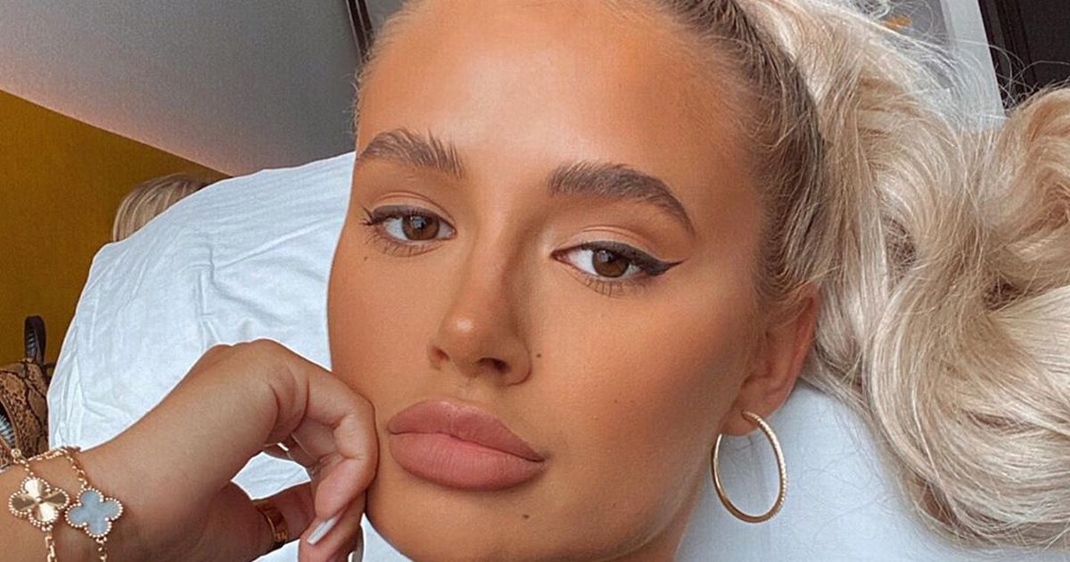 Molly-Mae Hague unveils natural lips for first time as she gets fillers removed