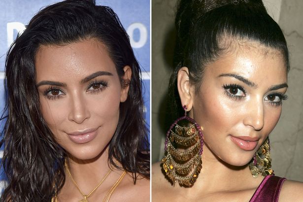 Kim Kardashian before and after nose job