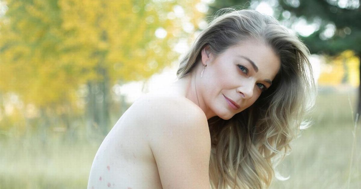 LeAnn Rimes feels ‘overwhelmed’ by support after sharing nude psoriasis snaps