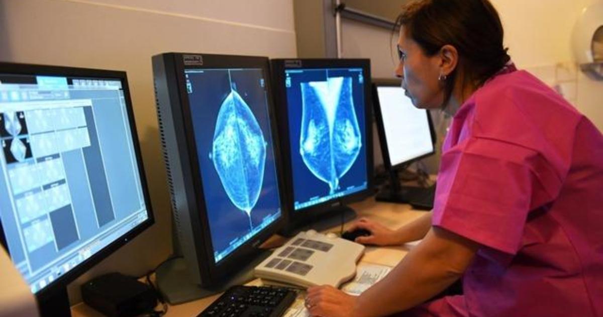 The importance of scheduling mammograms, even amid the pandemic