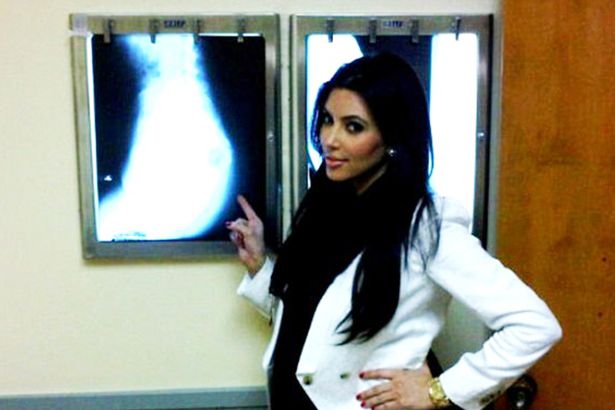 In 2011 Kim had an x-ray to prove she hadn't had implants