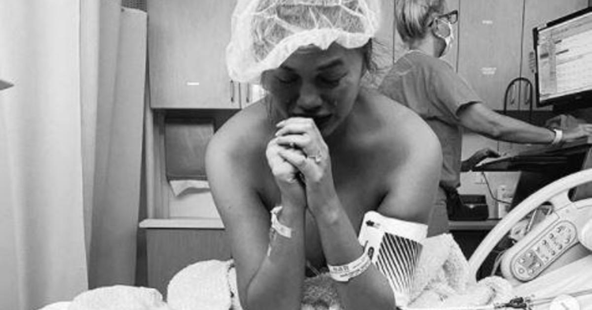 Chrissy Teigen shares heartbreaking news of pregnancy loss