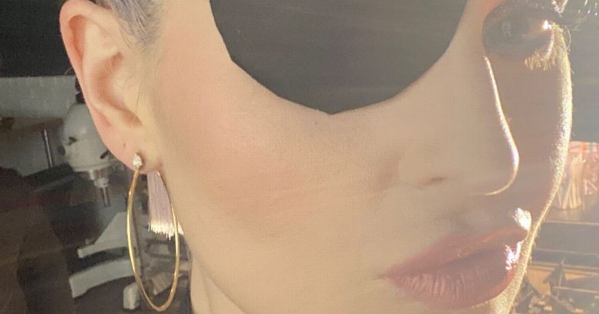 Kelly Osbourne forced to wear an eye patch after painful makeup disaster