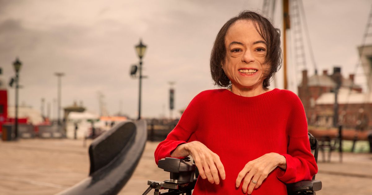 Liz Carr says disabled actors ‘must be seen’ to change discrimination they face