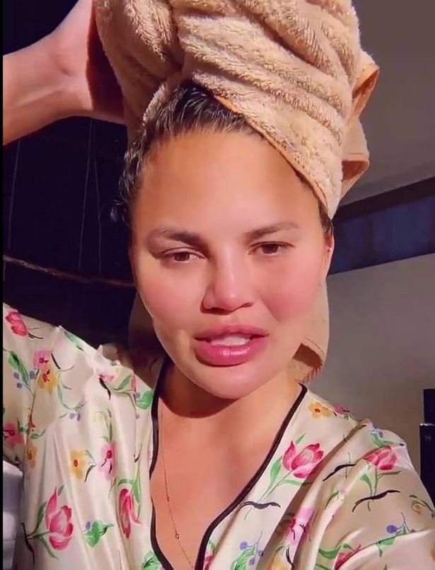 Chrissy Teigen