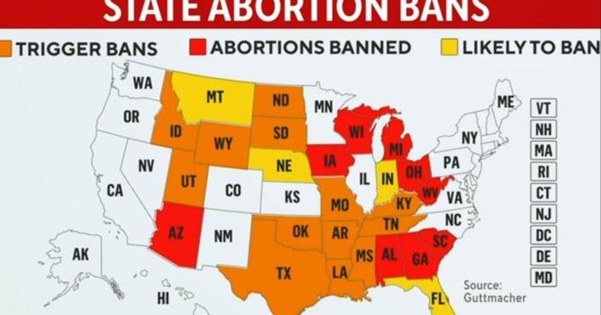 Impact of state abortion bans after Roe v. Wade is overturned