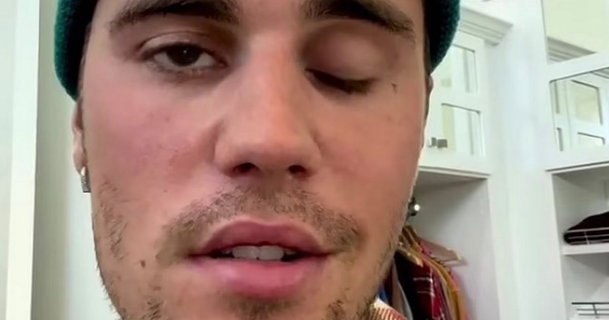 Justin Bieber tearfully asks fans ‘pray for me’ as he battles facial paralysis