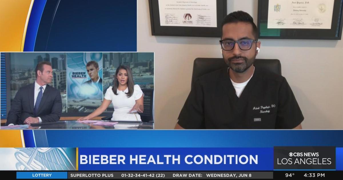 Expert explains Ramsay Hunt Syndrome, which Justin Bieber suffers from