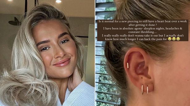 Molly-Mae Hague in 'absolute agony' as she asks fans for advice on new piercing