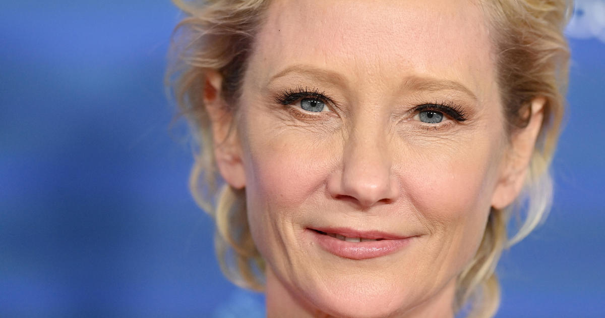 Anne Heche “not expected to survive” injuries suffered in fiery car crash