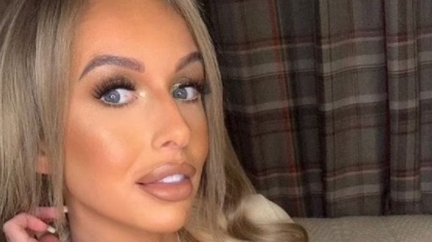 Faye Winter has revealed she is still in therapy since leaving the Love Island villa more than a year ago