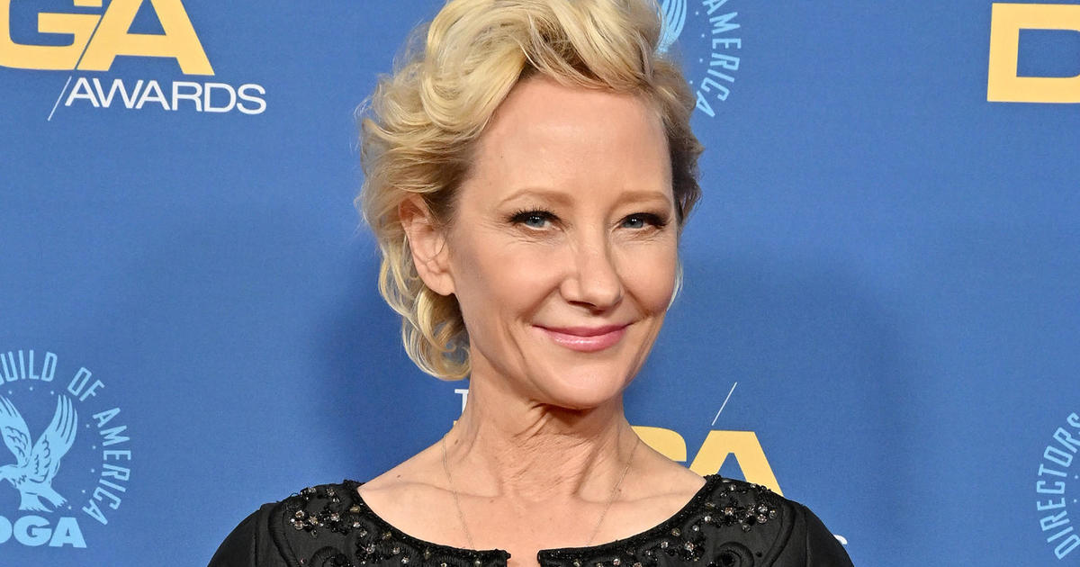 Anne Heche in a coma in “extreme critical condition,” manager says