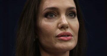 Pictures of Angelina Jolie's bruises after alleged Brad Pitt 2016 fight revealed