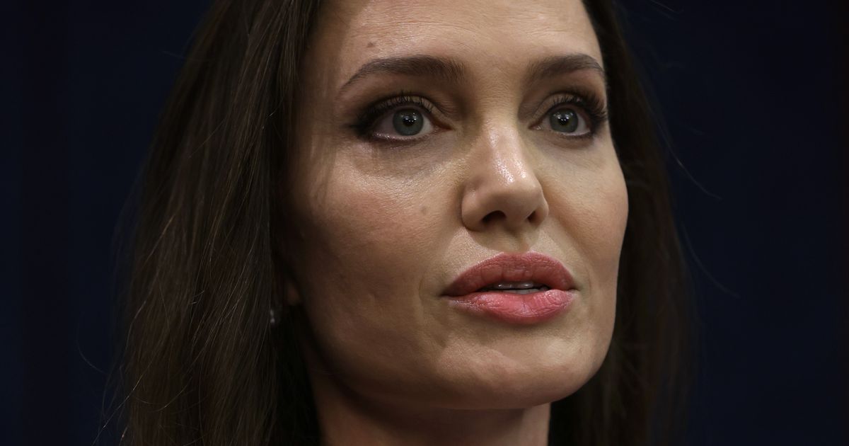 Pictures of Angelina Jolie’s bruises after alleged Brad Pitt 2016 fight revealed