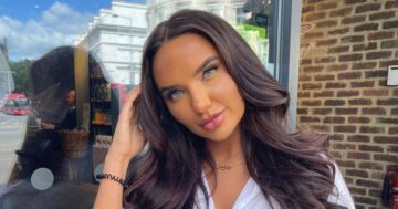 Love Island's Jazmine needs daily hospital visits after terrifying sepsis battle